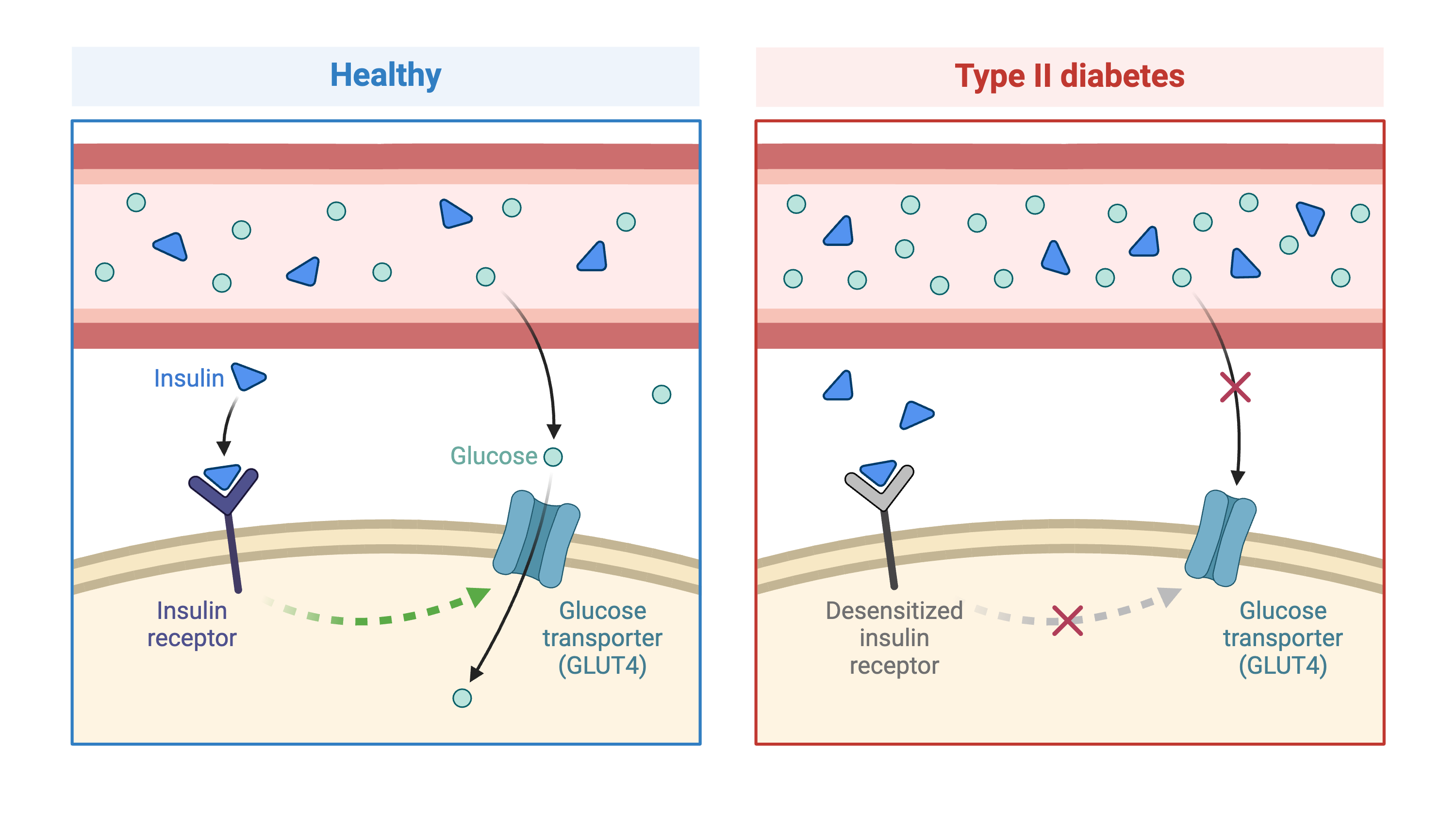 Figure showing Type 2 diabetes and insulin.