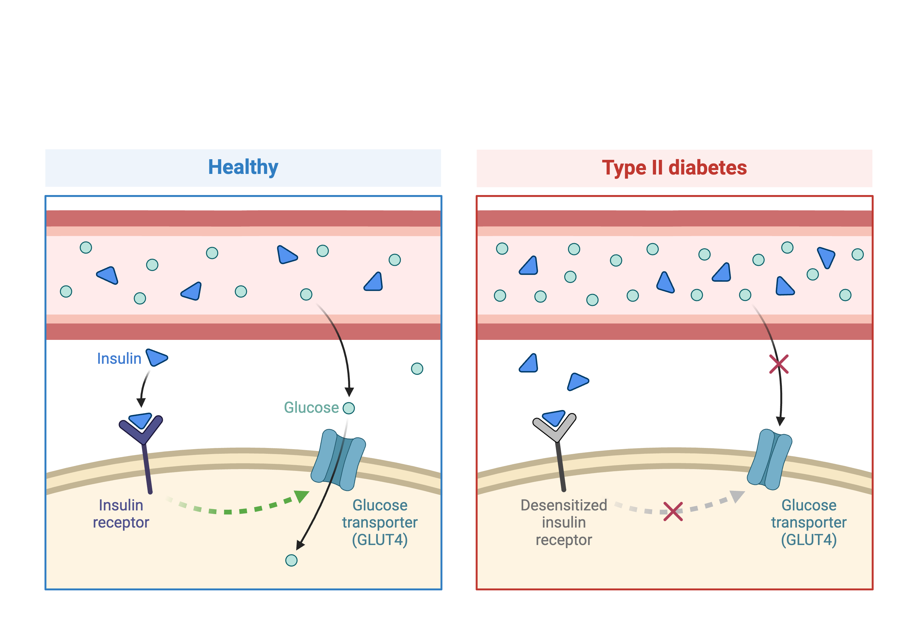 Figure showing Type 2 diabetes & insulin.