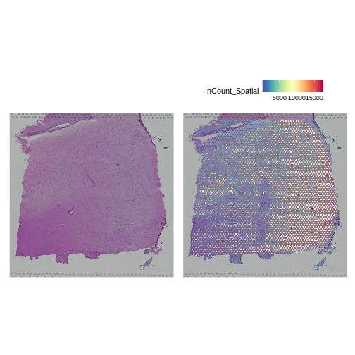 Figure showing UMI counts in each spot with varying intensity across the tissue