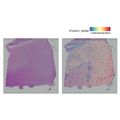 Figure showing number of genes detected in each spot with varying intensity across the tissue