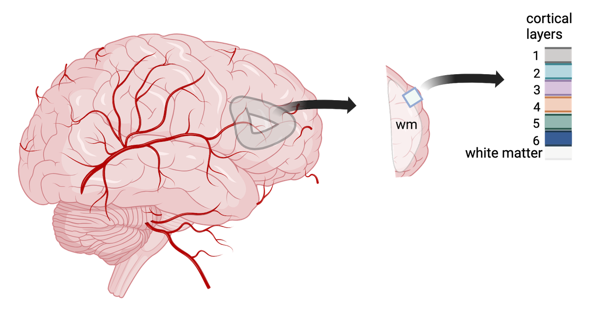 A human brain showing a section of dorsolateral prefrontal cortex extracted. A block of tissue containing six cortical layers and an underlying layer of white matter is excised from the section.