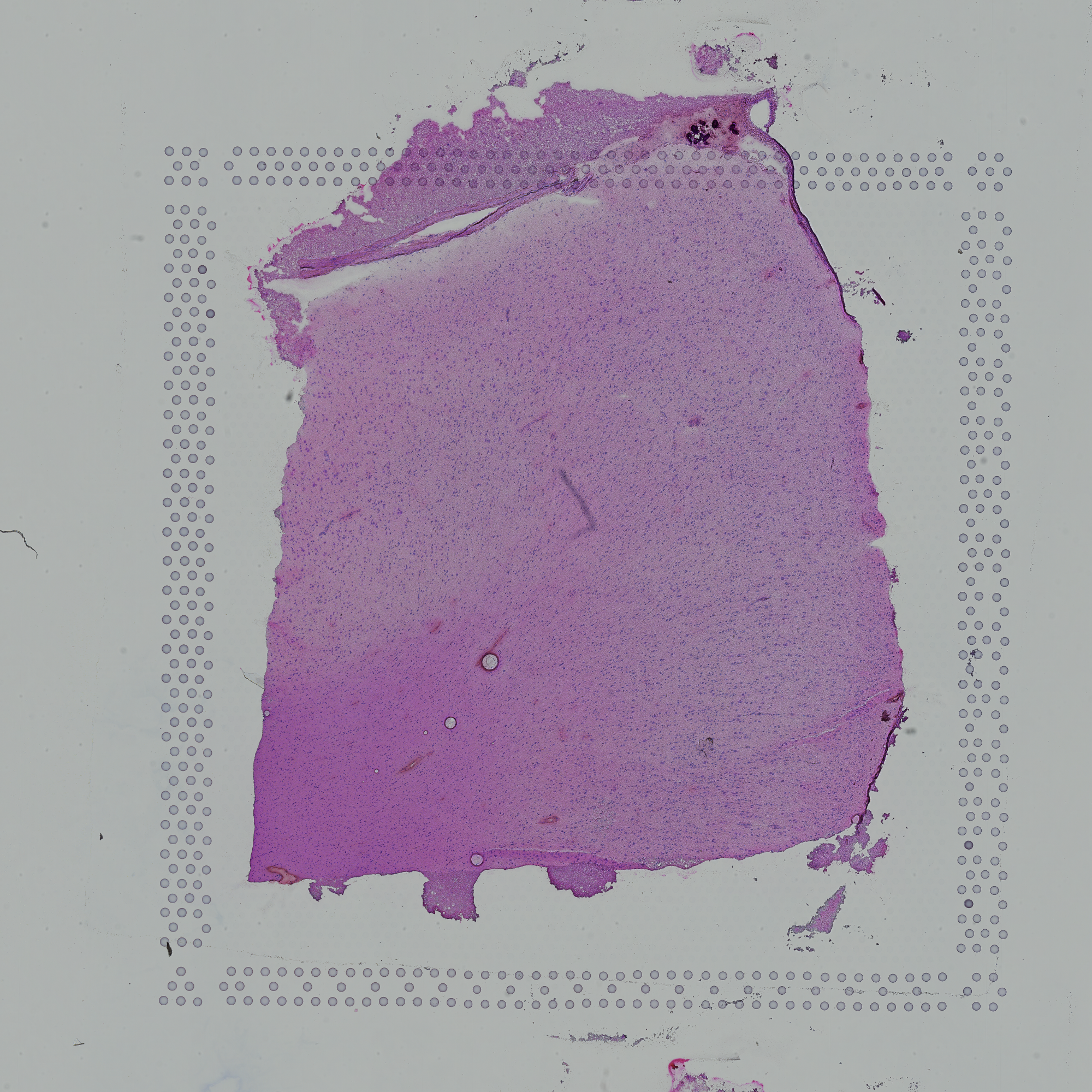 H & E slide of sample 151673